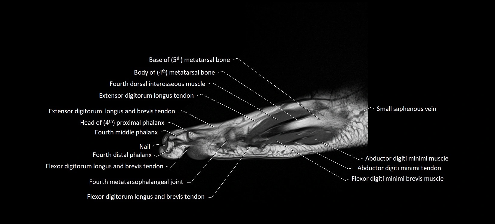 MRI foot sagittal labelled cross sectional anatomy image  21.webp